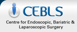 CEBLS - Centre for Endoscopic, Bariatric & Laparoscopic Surgery